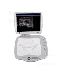 Echographe HD Sonoscanner Orcheo Lite