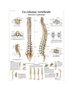 Planche plastifiée "La colonne vertébrale"