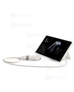 T-Lite EXP Echographe Sonoscanner portable écran 10’’