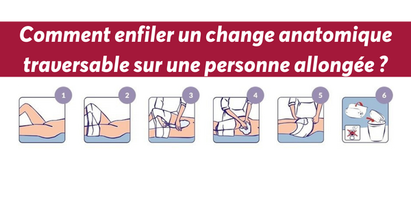 change anatomique traversable