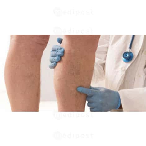 Escabeau de phlebologie 2 marches M02