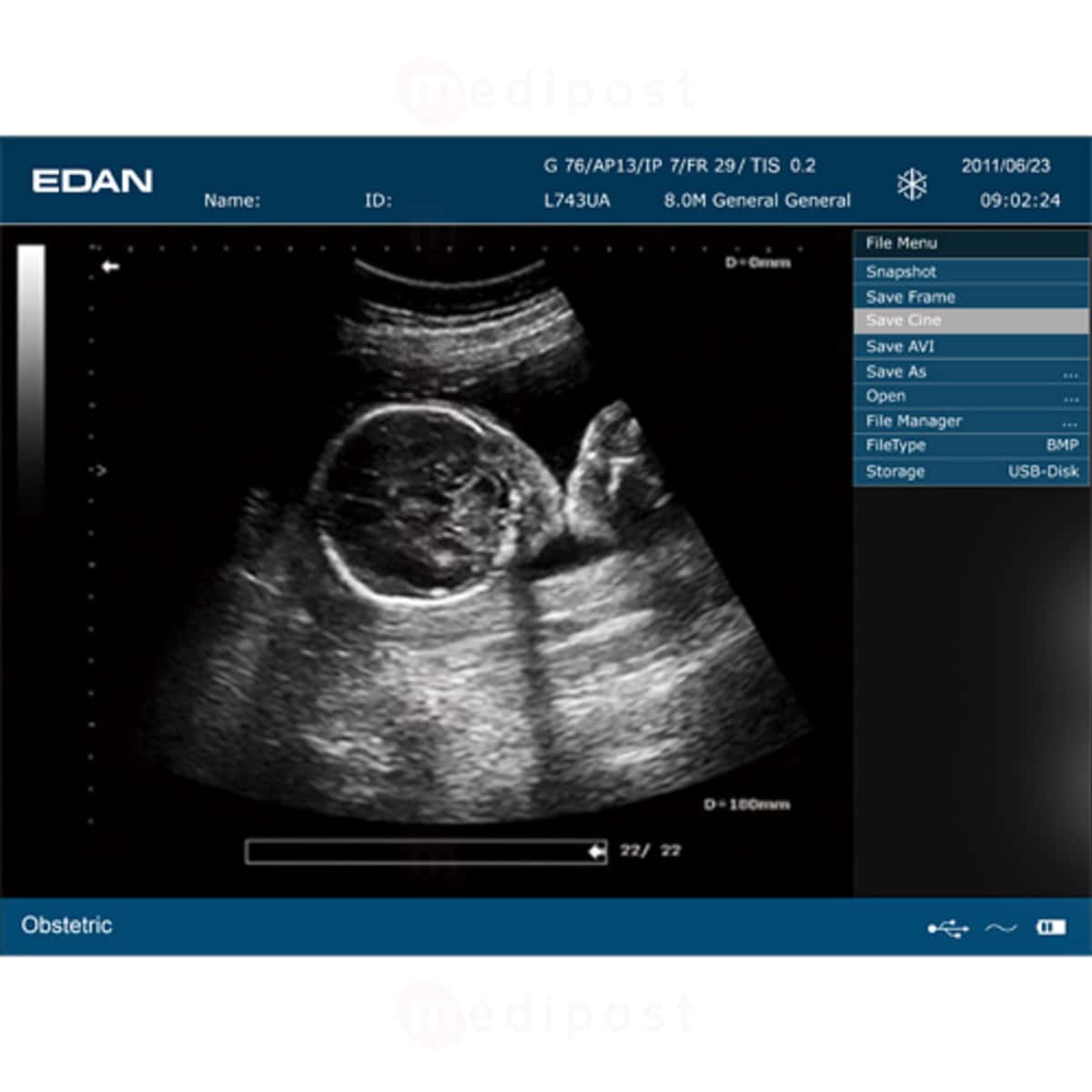 Echographe Edan DUS 60 sans sonde M02