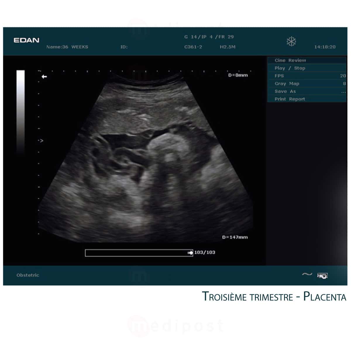 Echographe Edan DUS 60 sans sonde M03