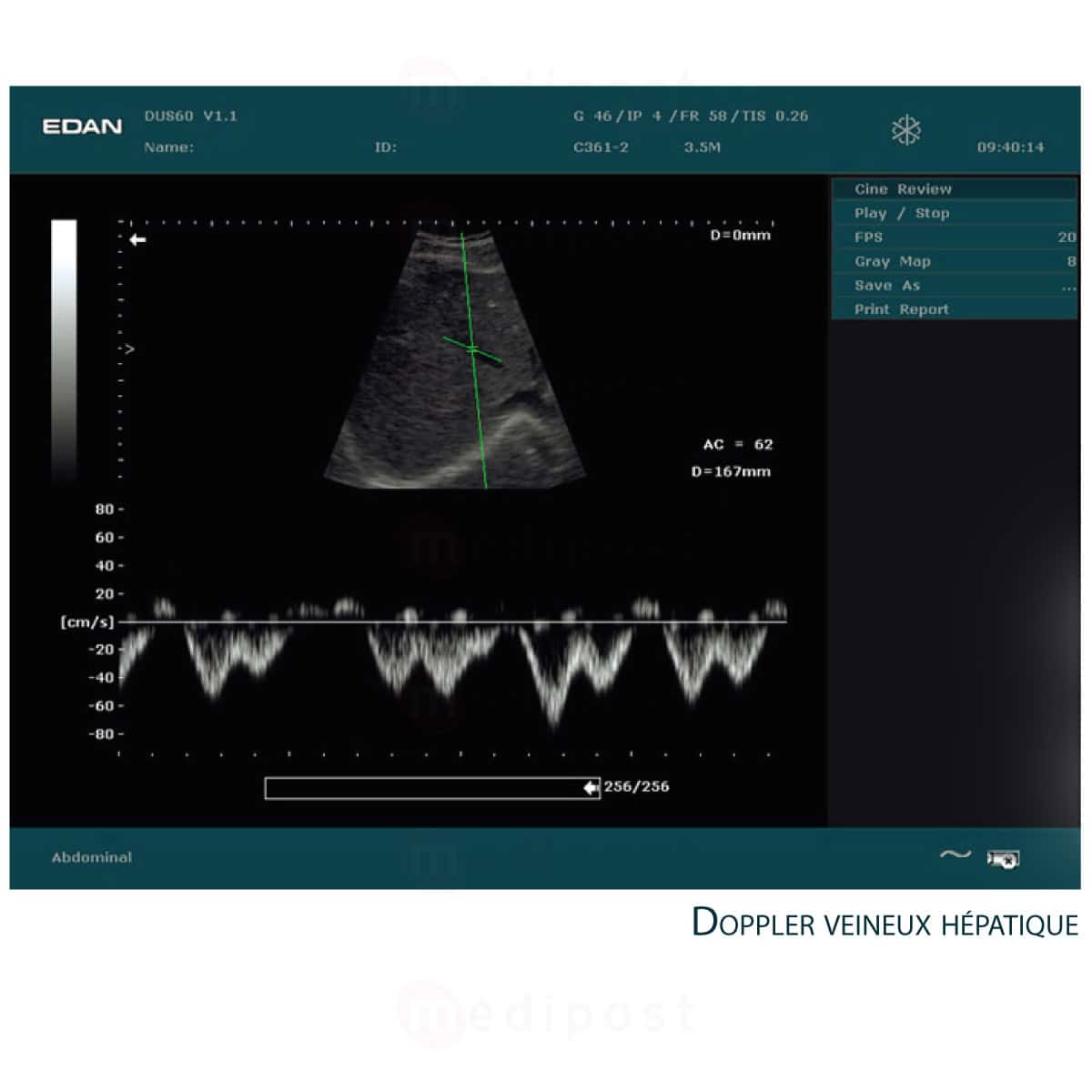 Echographe Edan DUS 60 sans sonde M04