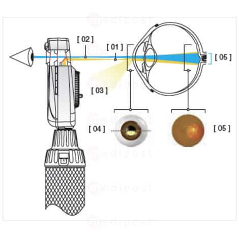 Ophtalmoscope HEINE BETA 200 S LED 3 5V M02
