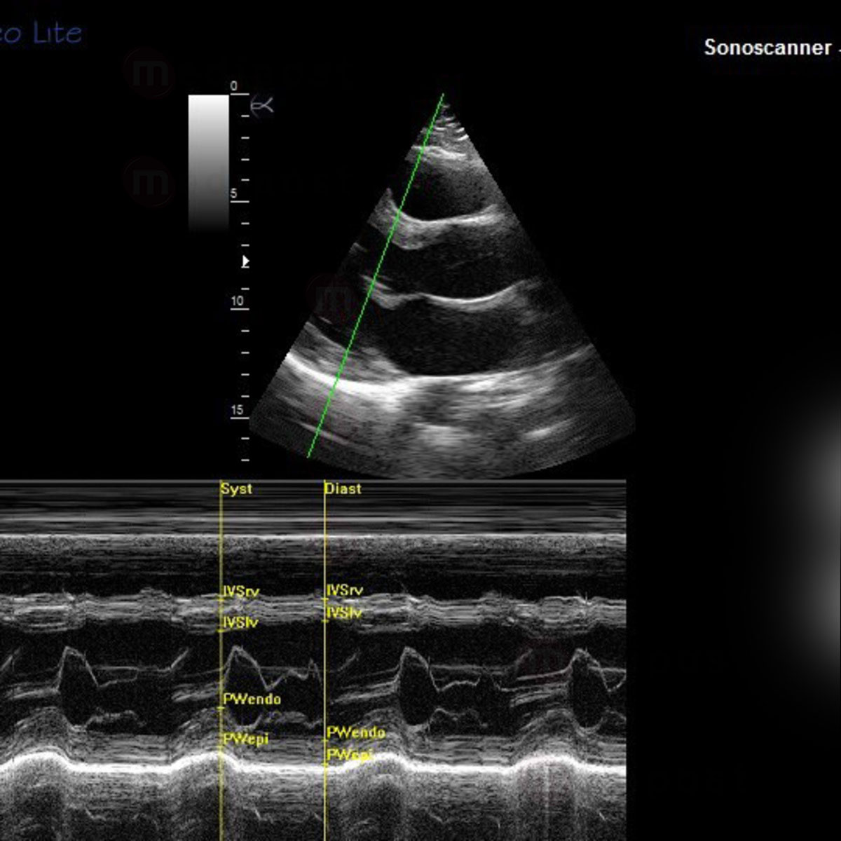 ORCHEOLITE Echographe HD Sonoscanner Orcheo Lite M7