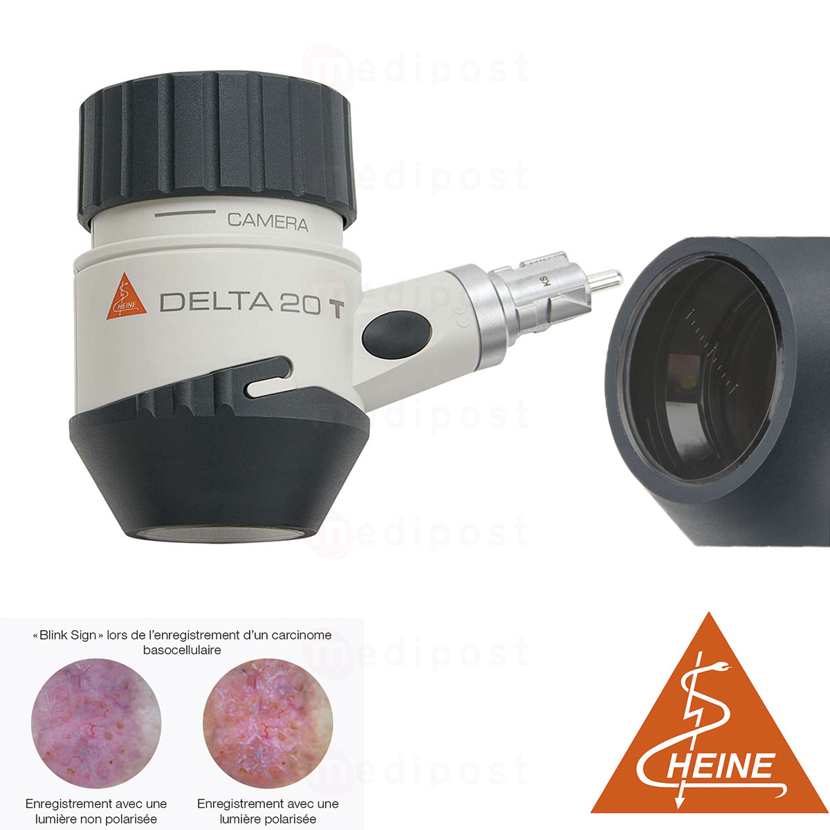 K00834221 Dermatoscope Delta20T Heine M4