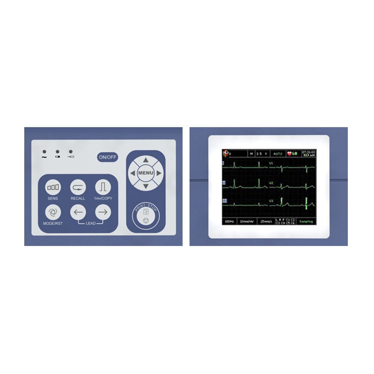 EDAN VE300 VETERINARY ECG controls M02