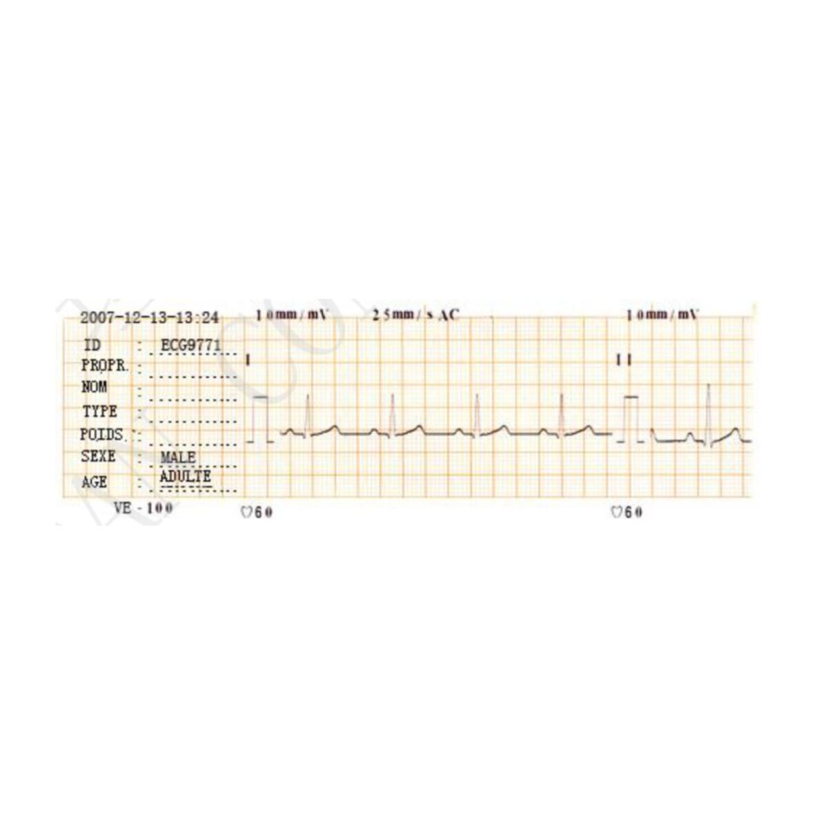 ECG VETERINAIRE VE100 EDAN M02