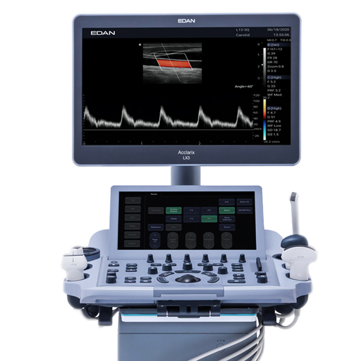 83.63.560522 Echographe Edan Acclarix LX3 M04