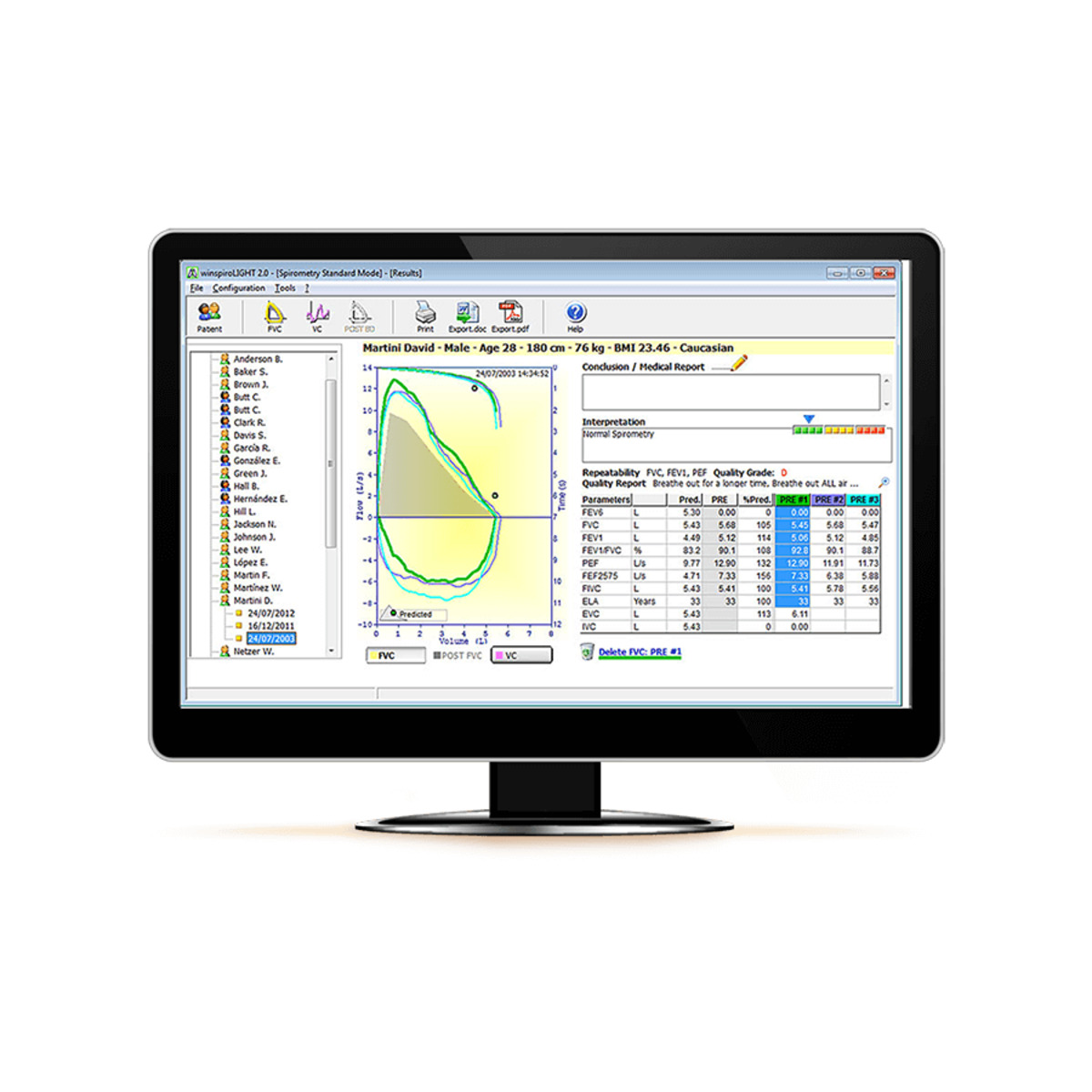 911003 Spiromètre MINISPIR 'Light' connecté, avec Logiciel PC M03