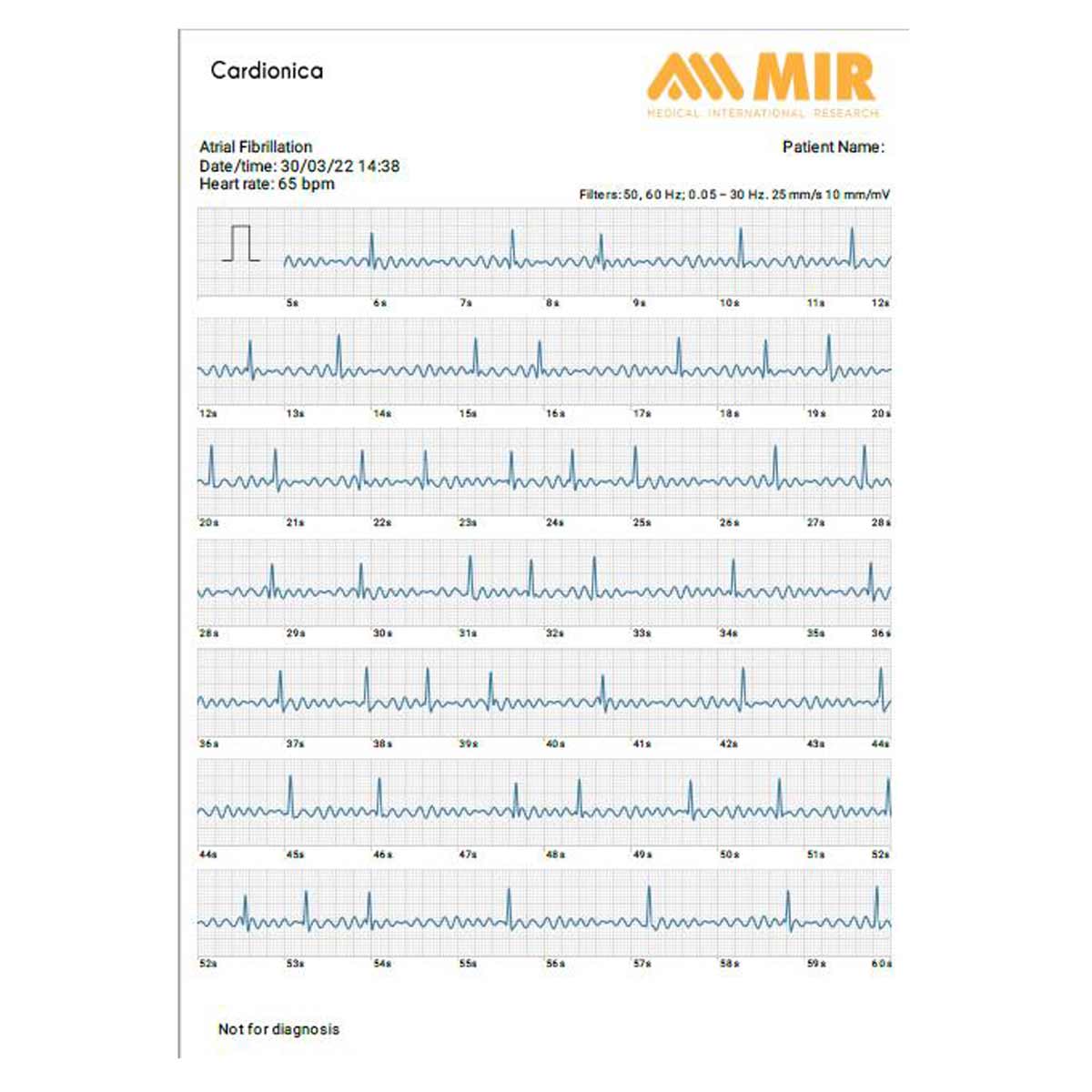 91200000 Moniteur ECG portable 1 dérivation Cardionica M04