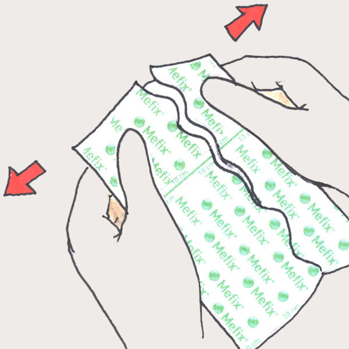 310250 Pansement de fixation non sterile Mefix M03