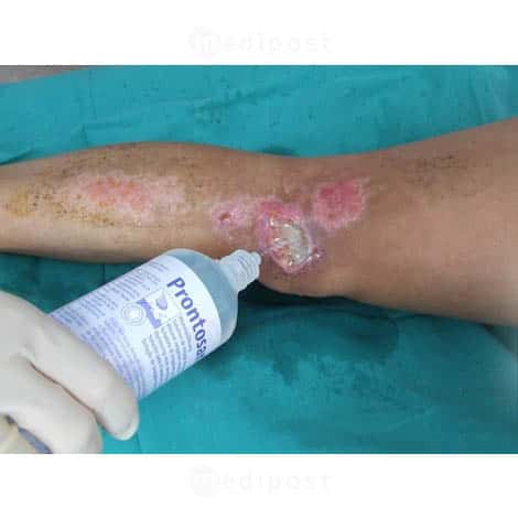 Prontosan 350ml Solution de lavage des plaies M02