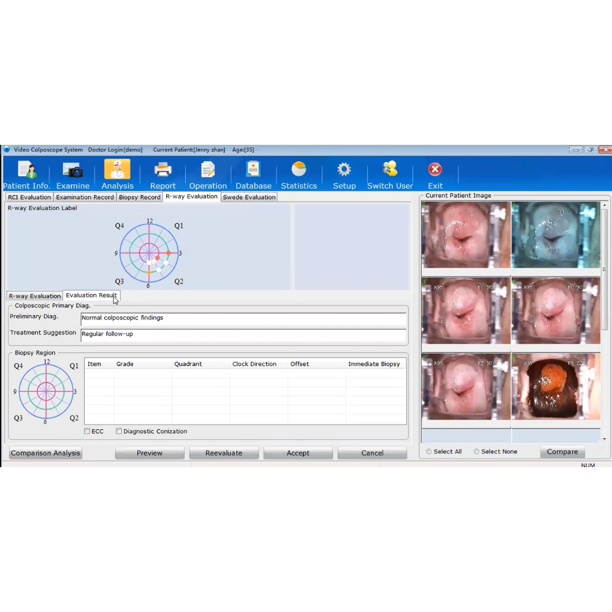 colposcope edan c6 M05