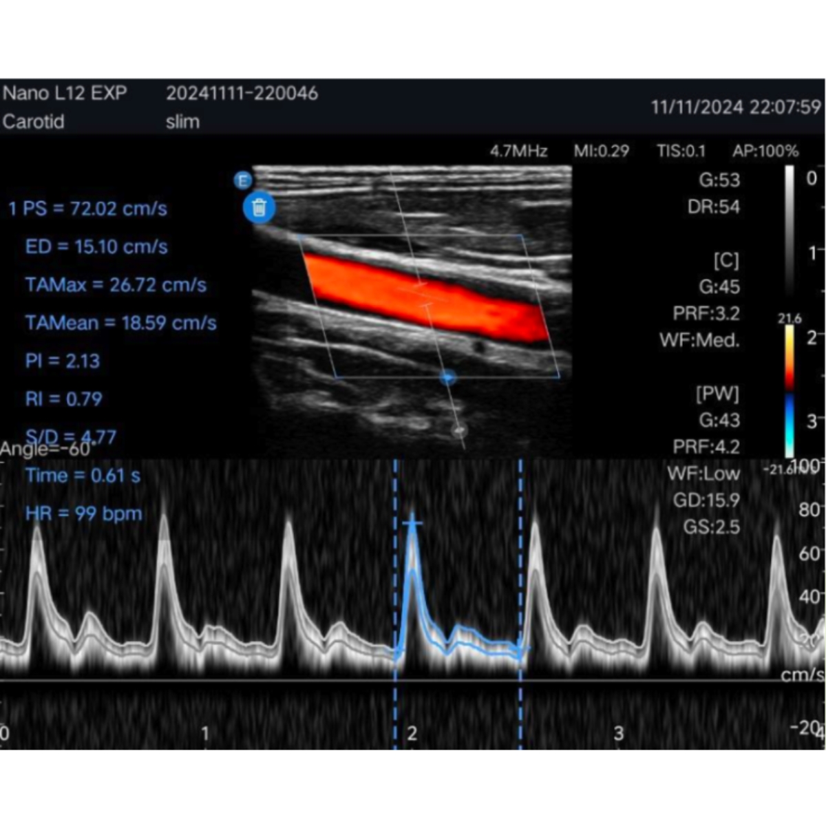 Echographe ultra-portable EDAN Nano L12 EXP M04