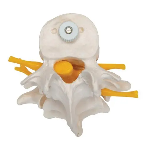 A76-8_08_3-Human-Lumbar-Vertebrae-Flexibly-Mounted.webp