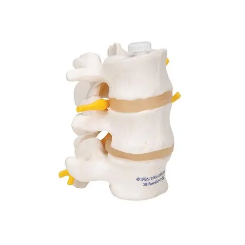 A76-8_02_3-Human-Lumbar-Vertebrae-Flexibly-Mounted.webp