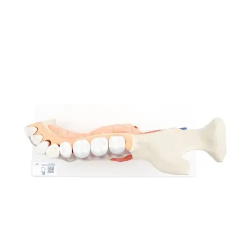 VE290_03_Comprehensive-Lower-Jaw-Model-Left-Half-with-Diseased-Teeth-Nerves-Vessels-Glands-19-part.webp