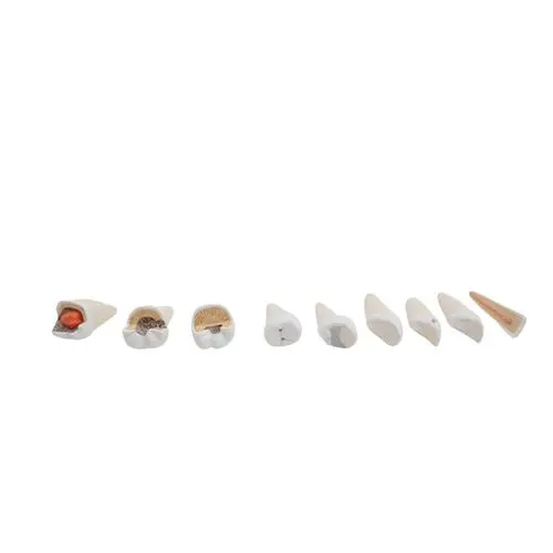 VE290_06_Comprehensive-Lower-Jaw-Model-Left-Half-with-Diseased-Teeth-Nerves-Vessels-Glands-19-part.webp