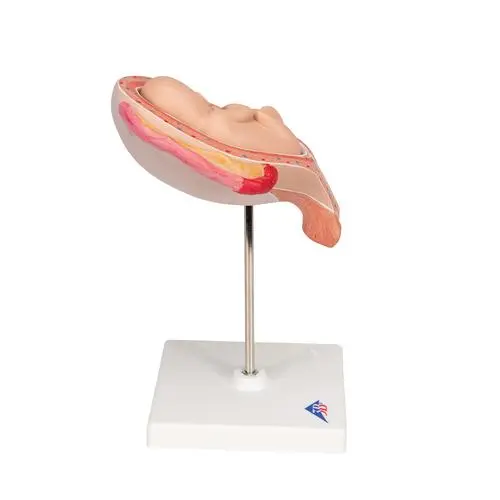 L10-5_03_Foetus-a-5-mois-presentation-du-siege.webp