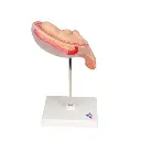 L10-5_03_Foetus-a-5-mois-presentation-du-siege.webp