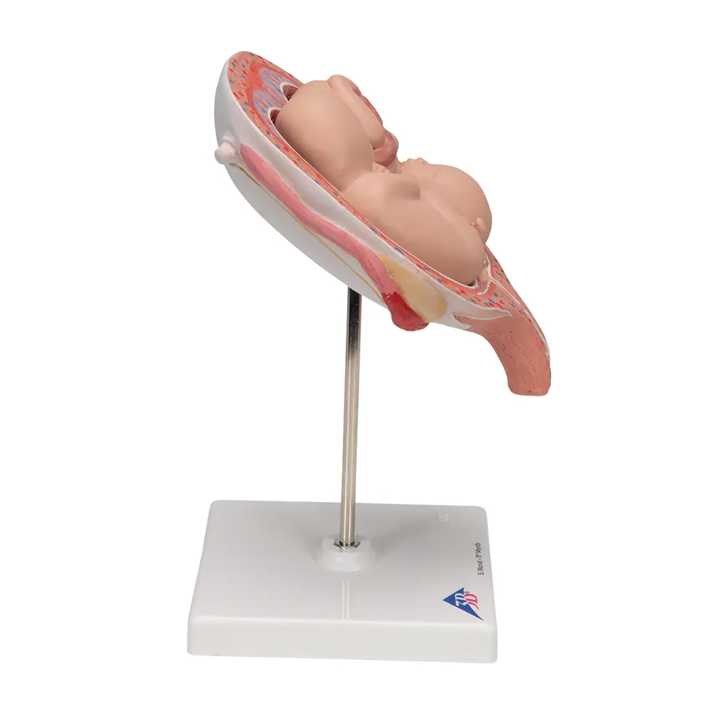 L10-7_03_1200_1200_Foetus-jumeaux-a-5-mois-position-normale.webp