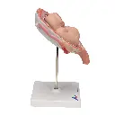 L10-7_03_1200_1200_Foetus-jumeaux-a-5-mois-position-normale.webp