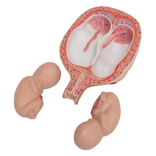 L10-7_07_Foetus-jumeaux-a-5-mois-position-normale.webp