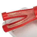 G40_08_Arteriosclerosis-Model-with-Cross-Section-of-Artery-2-part.webp