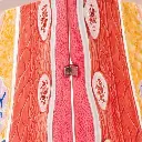 L56_05_Model-of-Female-Breast-with-Healthy-Unhealthy-Tissue.webp