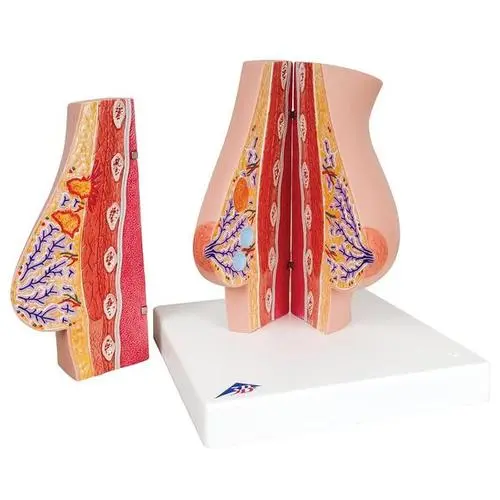 L56_02_Model-of-Female-Breast-with-Healthy-Unhealthy-Tissue.webp
