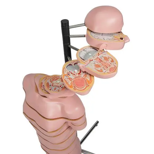 VA20_07_Torse-en-tranches-15-tranches.webp