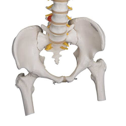 A59-2_05_Colonne-vertebrale-flexible-pour-la-forte-sollicitation-avec-des-moignons-de-femur