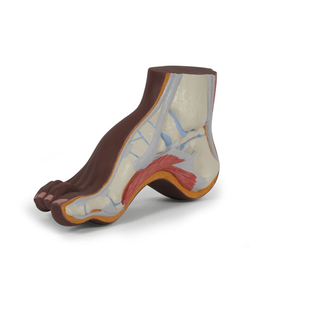 M32D_02_1200_1200_Hollow-Foot-Pes-Cavus-Model-dark-skin