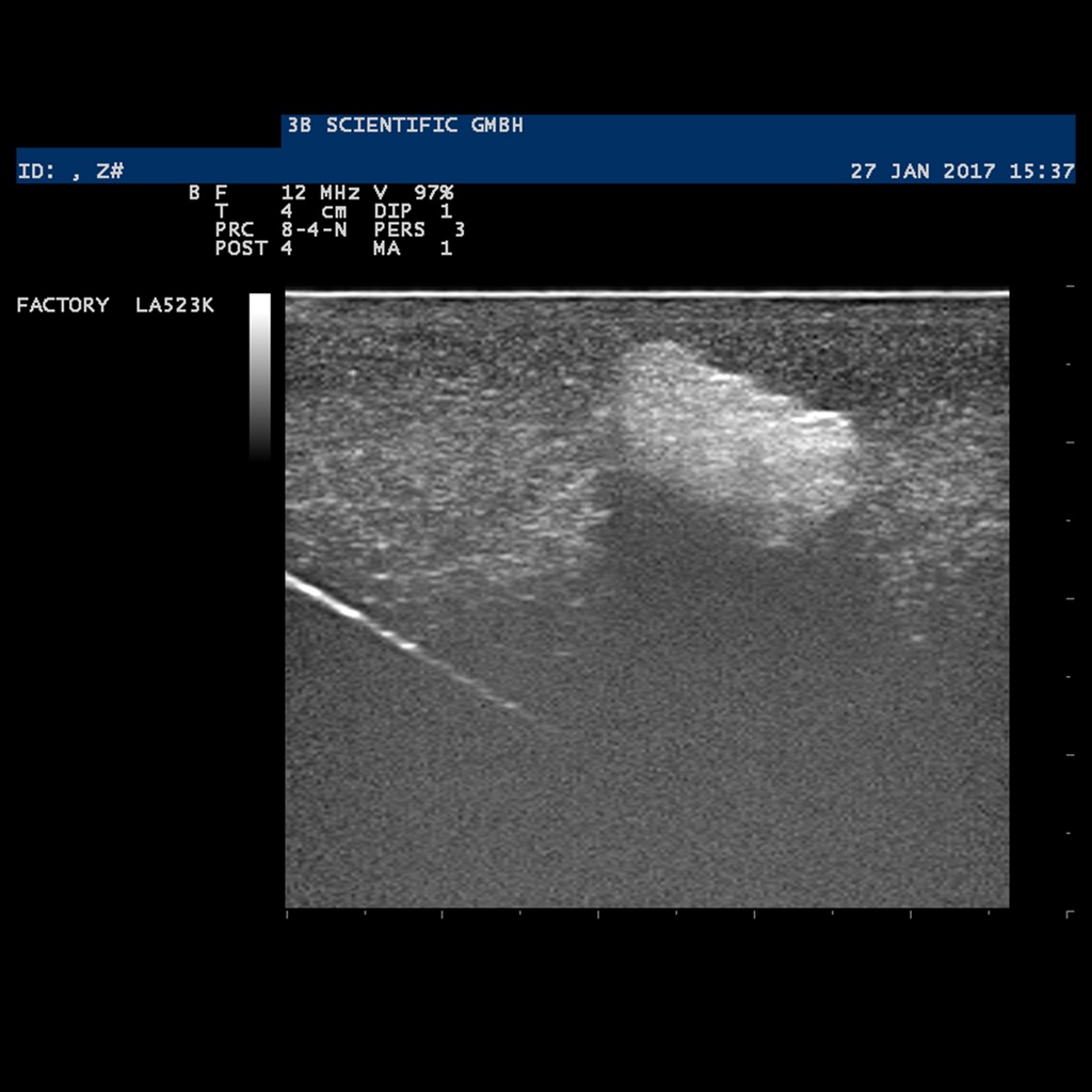 image_06
