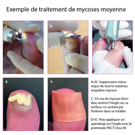 Kit de soins PACT Uree 40pommade 10gr lime pansement M03