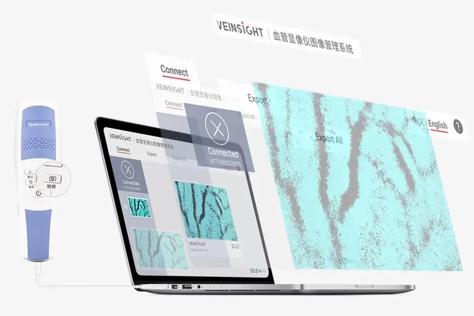 veinsight-vein-finder-feature-vs500-4.webp