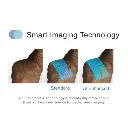 VS800-Vein-Finder-with-Smart-Imaging-600x600.webp