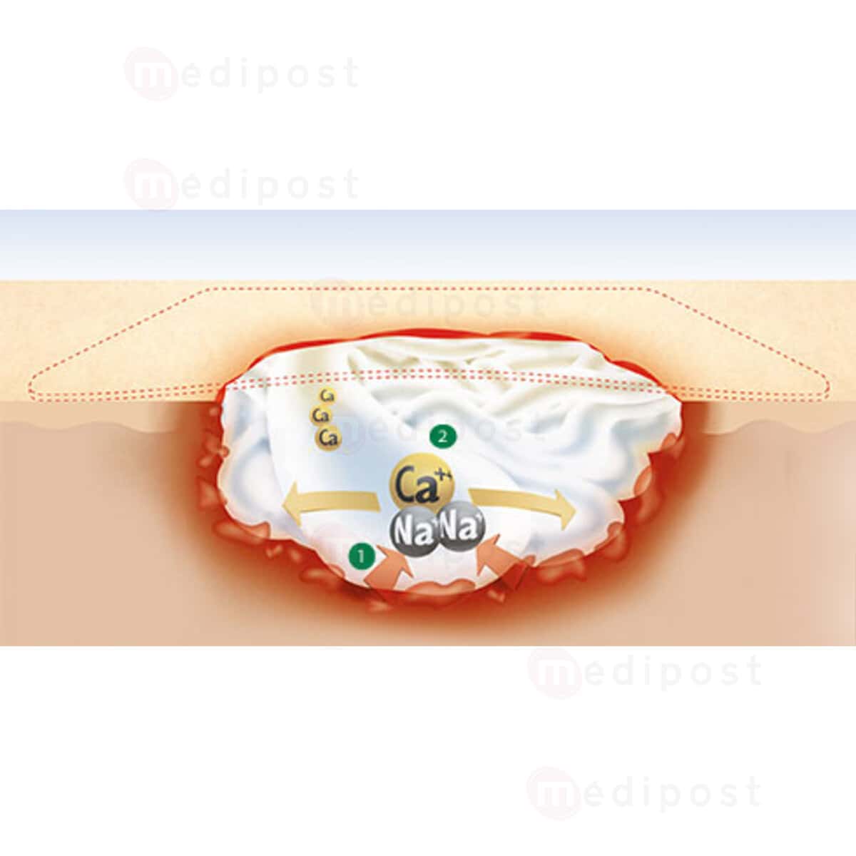Suprasorb A alginate 10x10cm M03