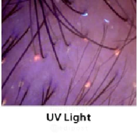 Dermatoscope microscope MFP avec leds UV M08