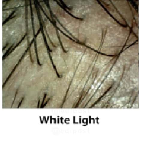 Dermatoscope microscope MFP standard M08