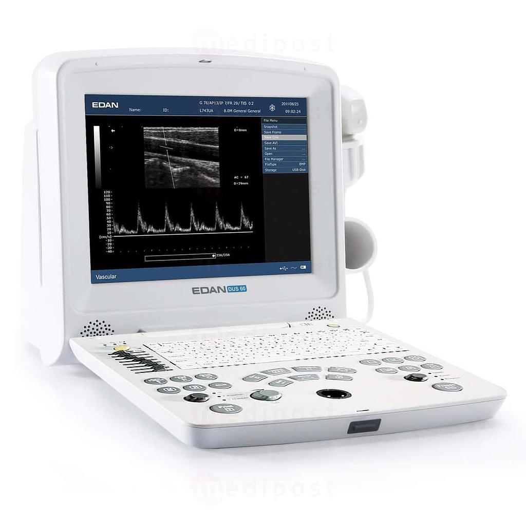 Edan DUS 60 ultrageluid scanner zonder sonde