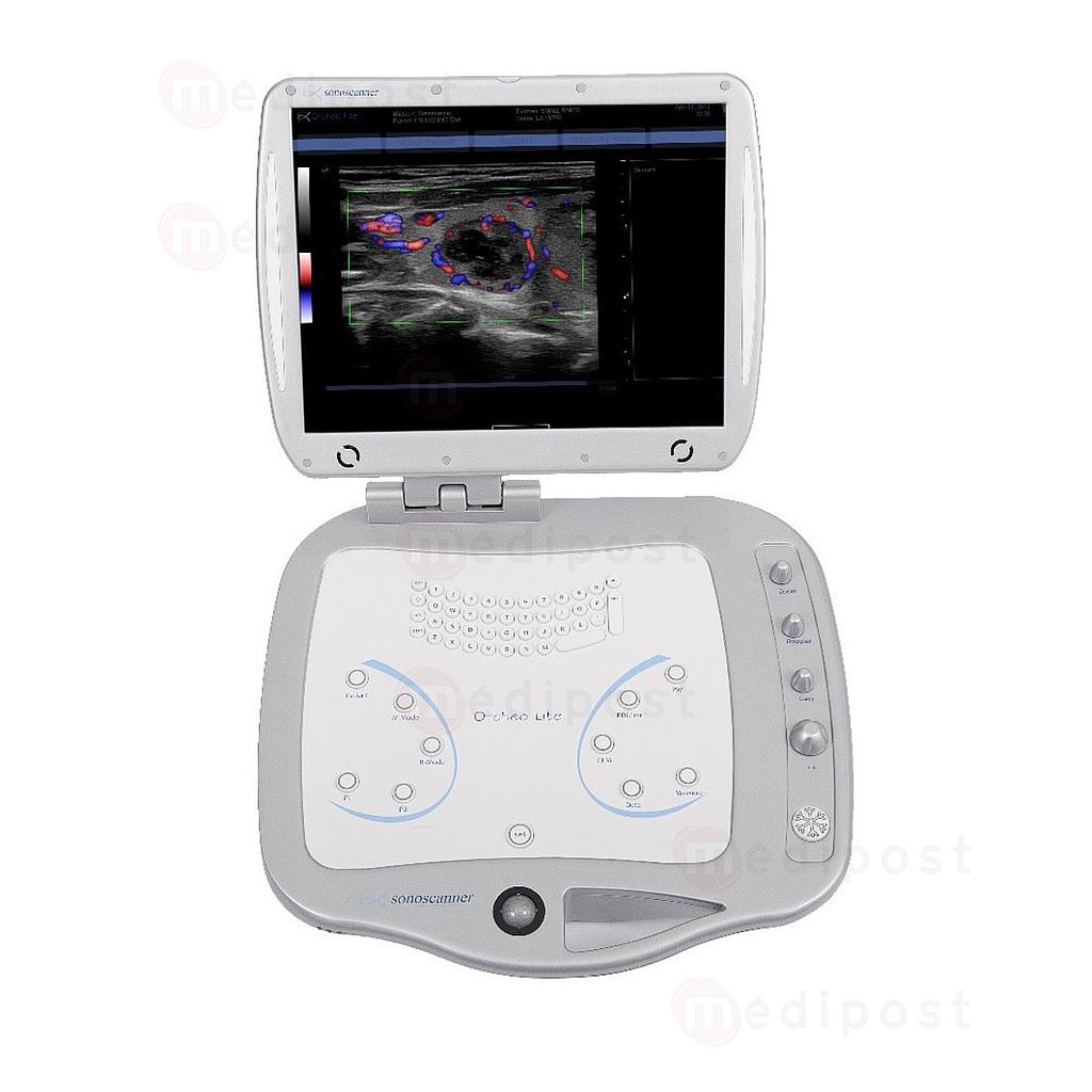 Echograaf HD Sonoscanner Orcheo Lite