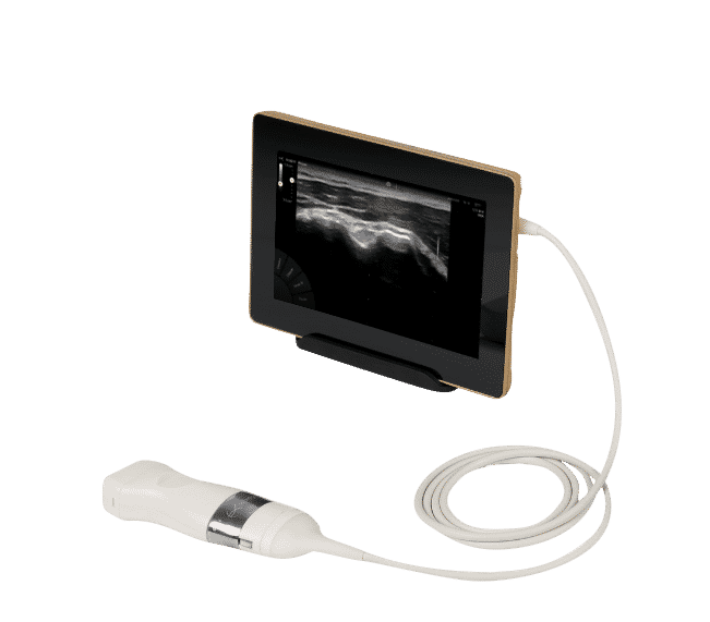 U-Lite EXP - Echographe Sonoscanner ultraportable