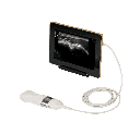 Sonoscanner U-Lite HD ultrageluidscanner