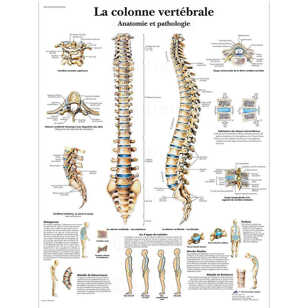 De rug" gelamineerd vel