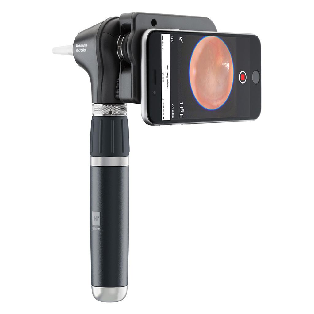 Otoscope Welch Allyn Macroview Plus iExaminer