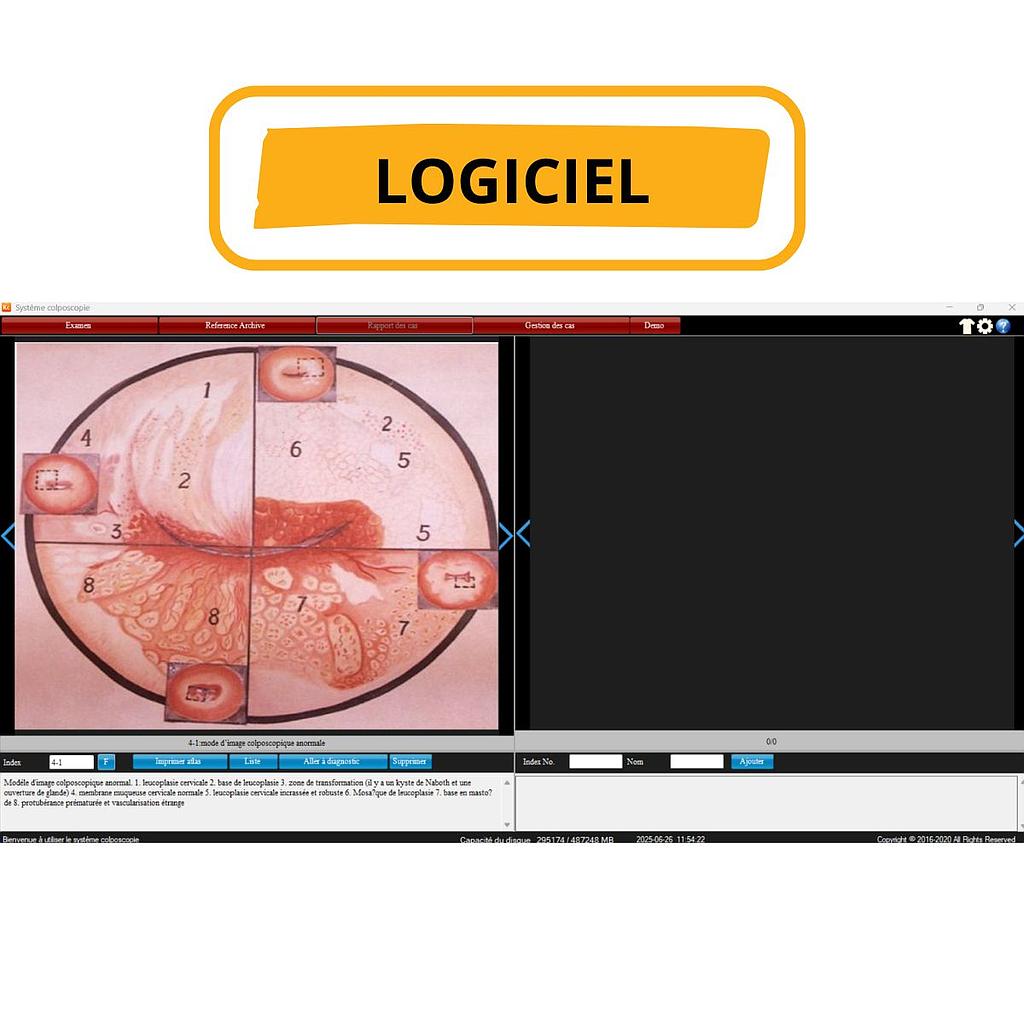 Carte de capture HDMI & Logiciel de Colposcopie Professionnel pour Vidéo-Colposcope DA HD