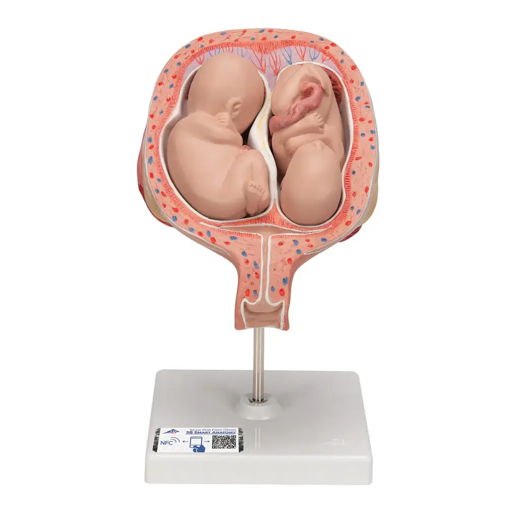 Fœtus jumeaux à 5 mois 3B Scientific® en position normale 